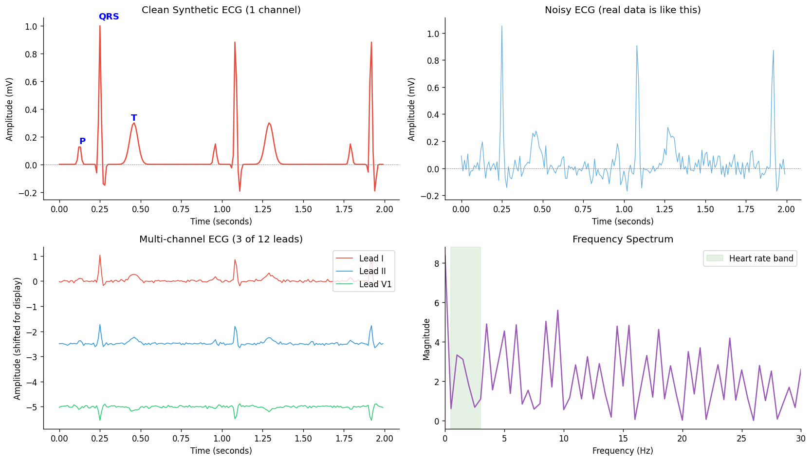 ../_images/e4483cff79beb513d798f5a60467af2df610bc60820b6f0aba00dba0234afc00.png